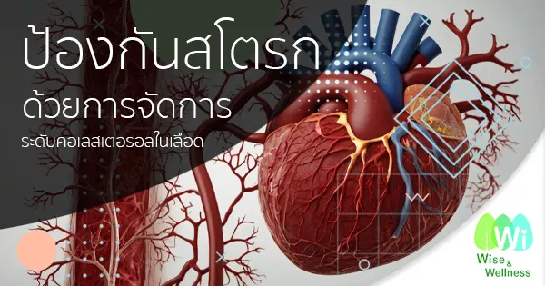 prevent-strokes-by-cholesterol